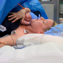 Load image into Gallery viewer, Joeyband Pro - Skin-to-Skin Device - Canadian Made Product 🇨🇦