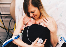 Load image into Gallery viewer, Joeyband Pro - Skin-to-Skin Device - Canadian Made Product 🇨🇦